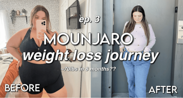 Mounjaro’s Weight Loss Before and After Pictures Tell a Story of ...